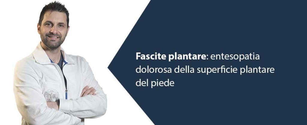 Fascite plantare