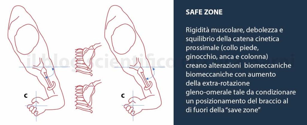 Impingement