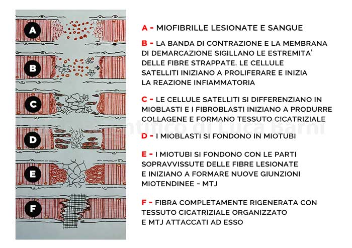 Tendo Capitis Longi Musculi Bicipitis Brachii - E-Anatomy - Foto 6