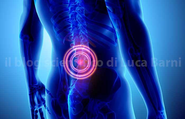 Back Low Pain cronico
